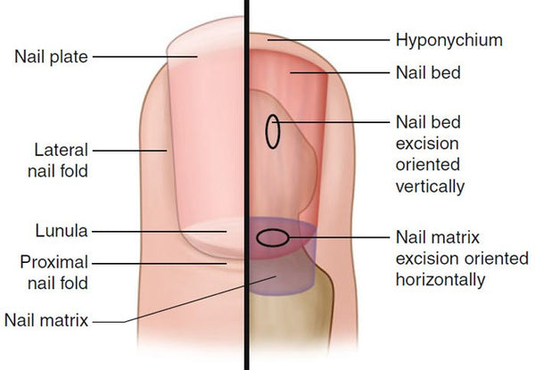 Basic Anatomy of a Nail